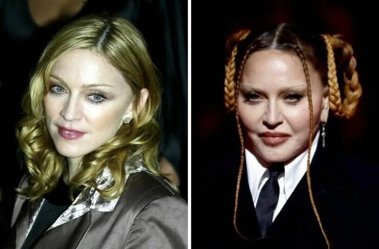 Madonna