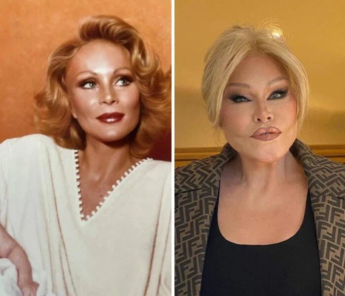 Jocelyn Wildenstein